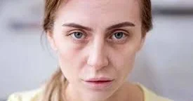 Bir baxışla qanazlığı diaqnozu qoymaq olmaz