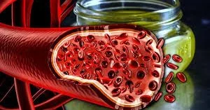 Damarları təmizləmək təhlükəlidir