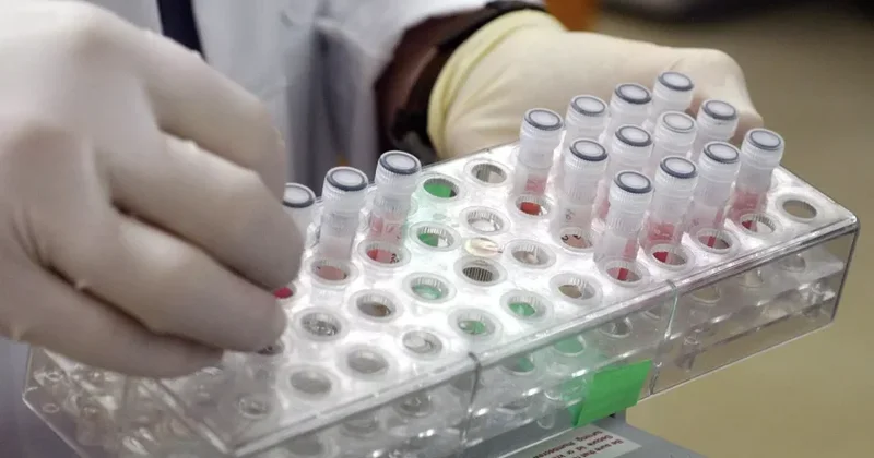 Saxlanılan laboratoriya ştammları sızarsa, fəlakətli nəticələr ola bilər BƏŞƏRİYYƏT TƏHLÜKƏDƏ