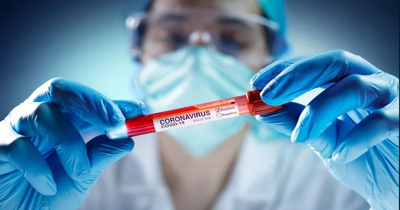 Bakıda koronavirus yayılıb? Tibbi ekspert açıqladı