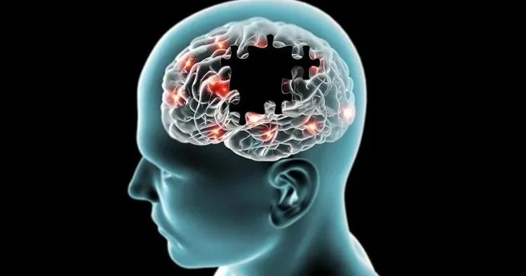Alzheimer xəstələri üçün ağıllı bilərzik kəşf olundu