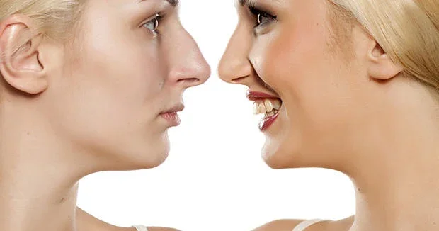 Psixoloqdan estetik əməliyyat istəyənlərə çağırış