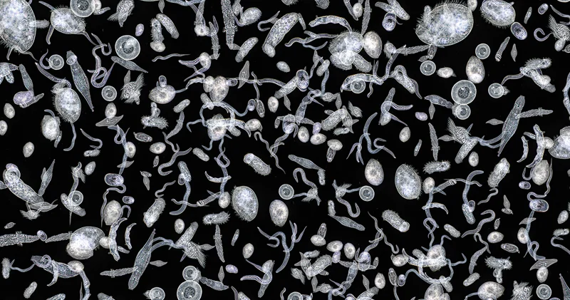 Alimlər virus kimi davranan yeni mikrob tapdı