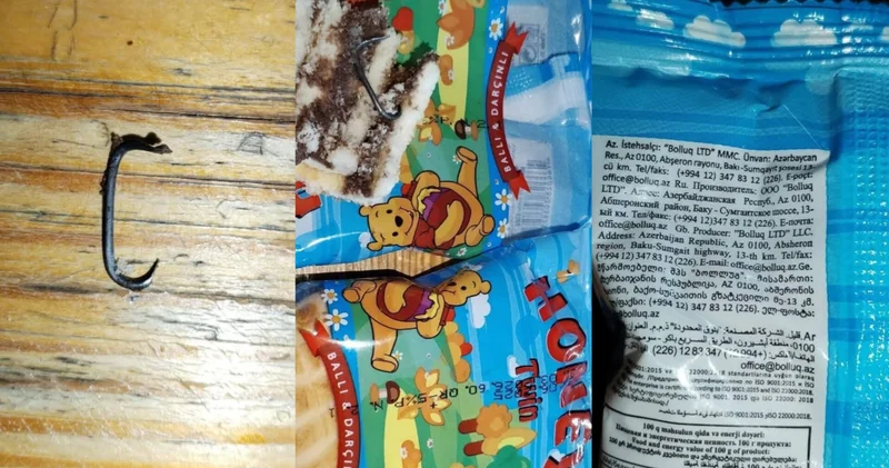Uşaq peçenyesindən dəmir parçası çıxdı