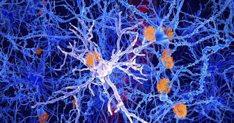 Alimlər Alzheimer xəstəliyinin beyin hüceyrələrini məhv etdiyi prosesi kəşf ediblər