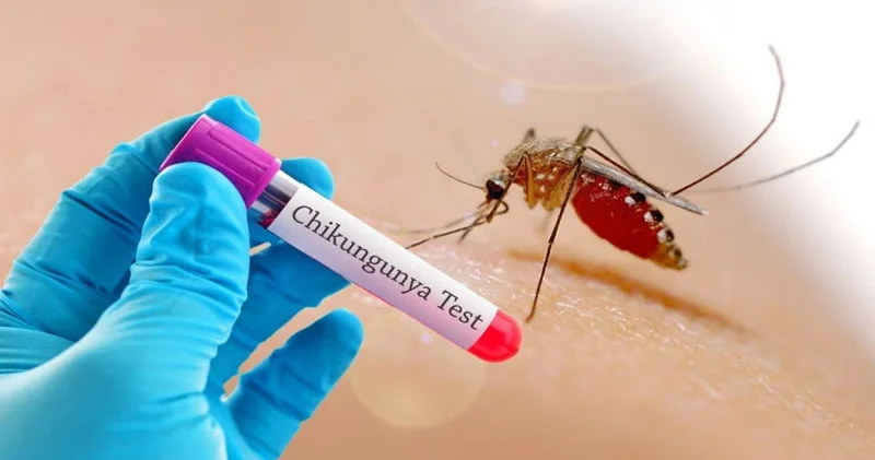 Azərbaycanda epidemioloji vəziyyət yenidən qiymətləndirilməlidir Professor