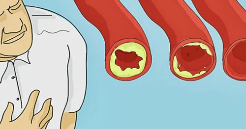 Damarları təmizləmək üçün bu RESEPTDƏN istifadə edin