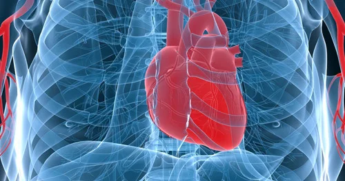 Lal infarkt. Kim təhlükədədir?