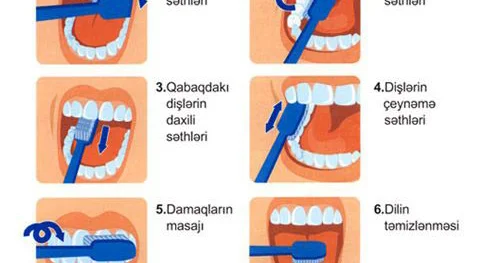 Siz dişlərinizi düzgün təmizləyirsinizmi?