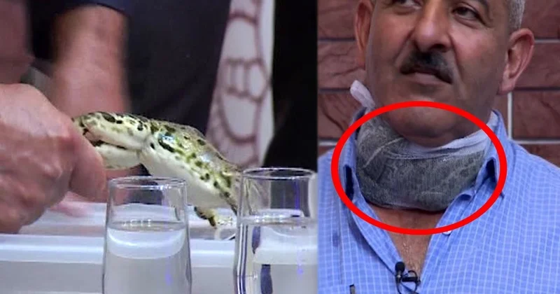 Zobu qurbağa ilə müalicə etmək düzgündürmü? DİQQƏT