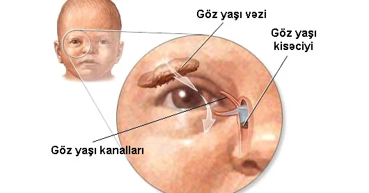 Körpənin gözlərindən irin axır. Nə etmək lazımdır? VİDEO