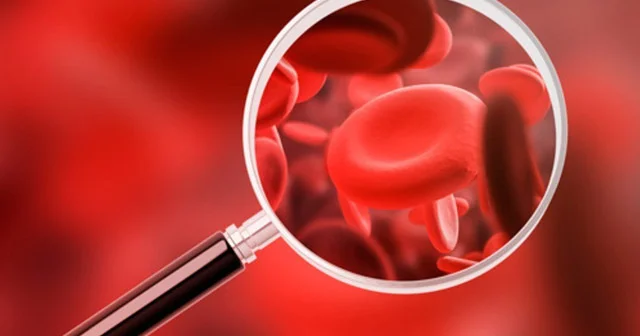 Qanda hemoqlobini artırmaq üçün bunları yeyin