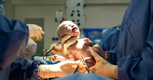 Hamilə qadınların nəzərinə! Epidural anesteziya daha təhlükəsiz olub