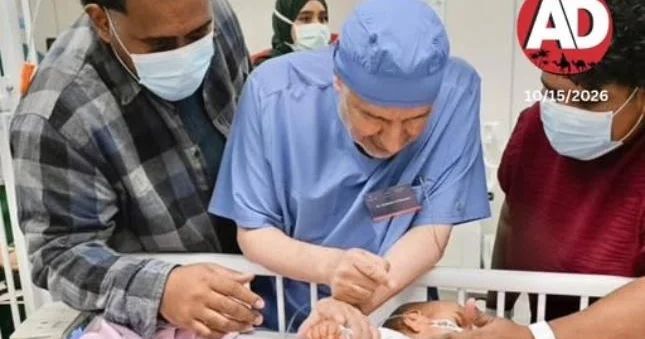 Səudiyyə Ərəbistanında bitişik əkizləri ayırmaq üçün mürəkkəb əməliyyata başlanılıb