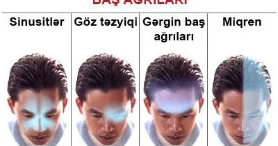 Miqreni müalicə etmək olarmı?