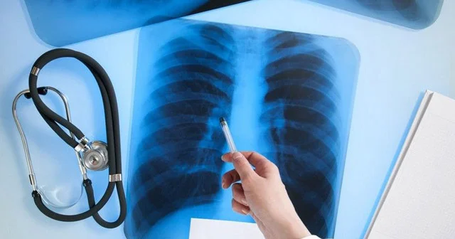 Azərbaycanda uşaqlar lazımsız yerə rentgen olunur, bu, dəhşətdir Pediatrdan AÇIQLAMA