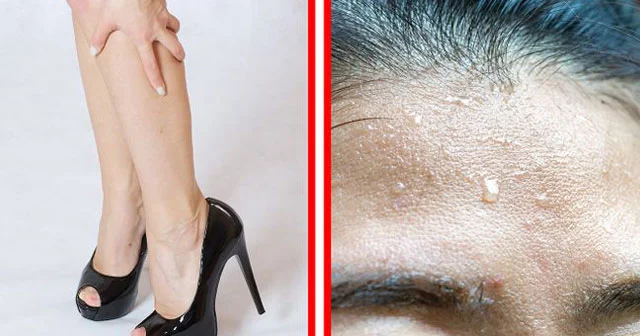 Vitamin D əskikliyini evdə özün təyin et