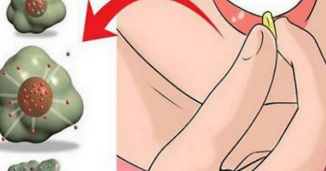 Xərçəngi yox edən 7 FAYDALI MƏHSUL