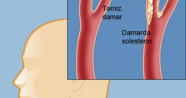 Xolesterinin və yüksək təzyiqin birinci düşməni. Hər gün 1 ovuc yeyin!