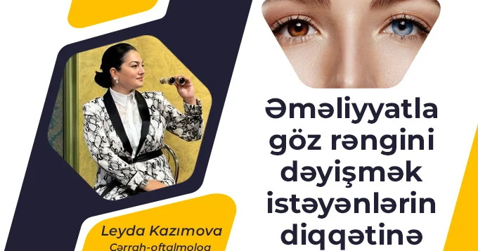 Göz rəngini əməliyyatla dəyişmək olur Həkim təhlükələrindən danışdı VİDEO
