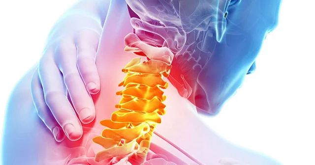 Boyun osteoxondrozunun təbii müalicəsi