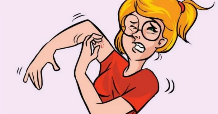 Qaşındıqca, qaşınır: SƏBƏBİ?