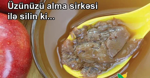 Üzünüzü alma sirkəsi ilə silin ki...