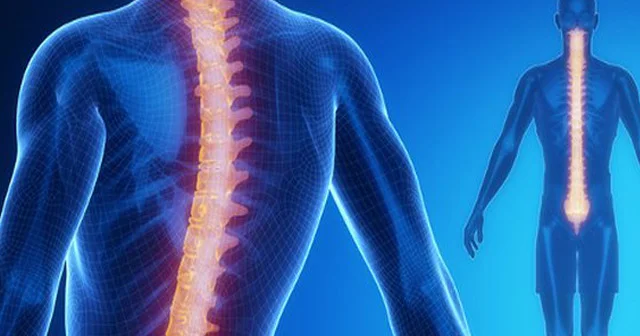 SKOLİOZun ağır fəsadları və müalicə üsulları