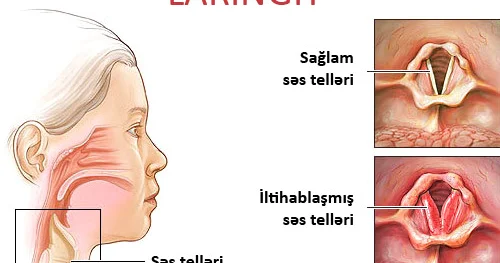 Səs batmasının səbəbləri. Diqqətli olun!