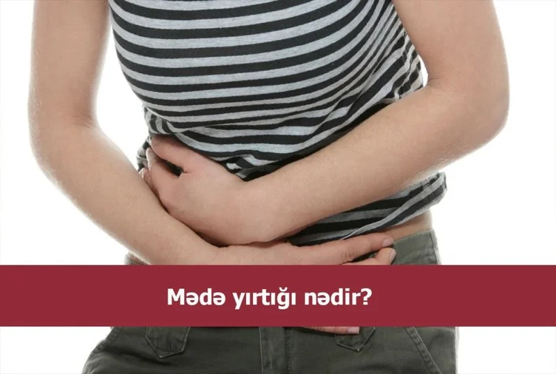 Mədə yırtığı nədir? Əlamətlər hansılardı? +VİDEO