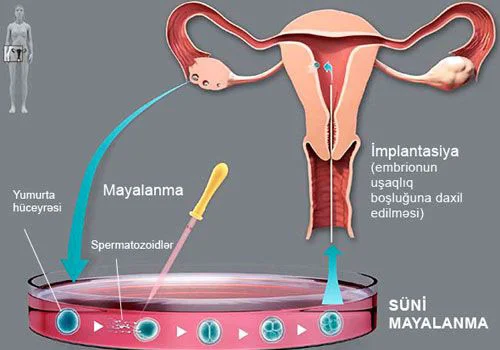 Yumurta hüceyrəsi donorluğu