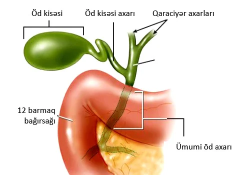 Xolangit öd axarlarının iltihabı