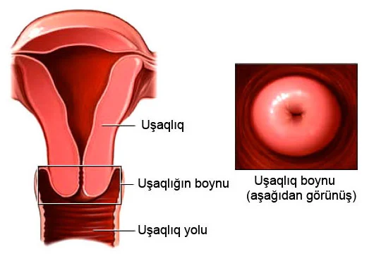 Uşaqlıq boynu eroziyası