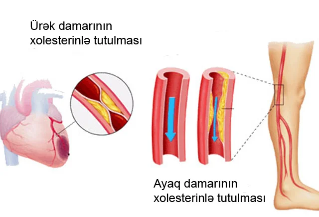 Damarları təmizləyən TƏBİİ VASİTƏLƏR. 7 faydalı resept