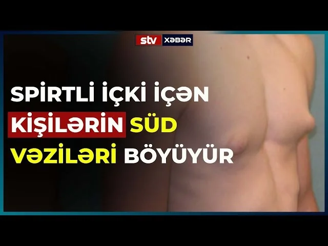 Spirtli içki içmək kişilərdə süd vəzilərini böyüdür Şok MƏLUMAT + VİDEO