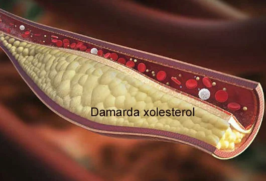 Damarları təmizləyən SADƏ VASİTƏ. Resept