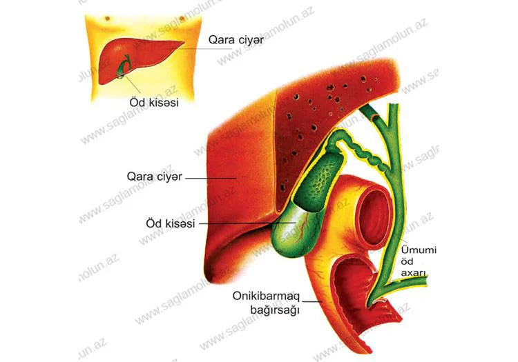 Öd daşı xəstəliyi