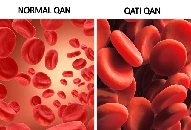 Qanı qatılaşdıran 5 içki Ürəyi xəstə olanlar ehtiyatlı olmalıdır!