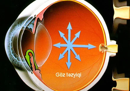 Göz təzyiqi nədir?