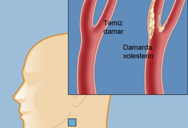 Xolesterinin və yüksək təzyiqin birinci düşməni. Hər gün 1 ovuc yeyin!