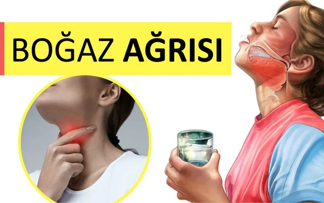 Boğaz ağrısı zamanı xalq təbabəti üsulları VİDEO