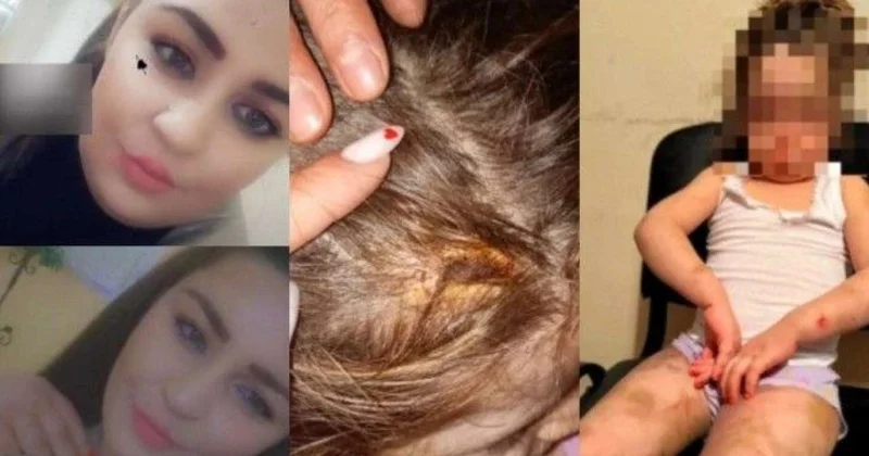 Bakıda ana 4 yaşlı qızına dəhşətli işgəncələr verdi: Kəmərlə döydü, bədənini yandırdı TƏFƏRRÜAT