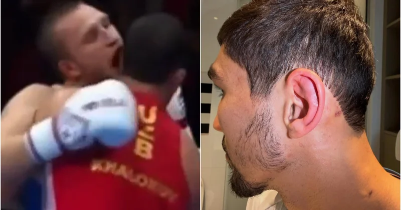Dünya çempionatının finalında qalmaqal: Rusiyalı boksçu rəqibinin qulağını dişlədi VİDEO