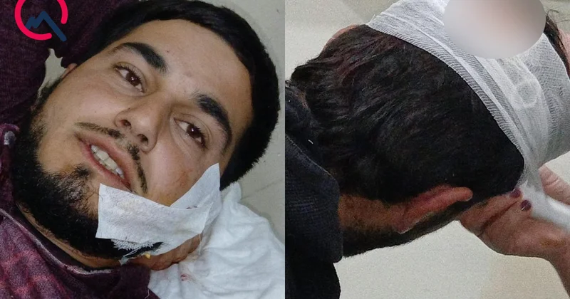 Ağdamda 2 qardaş 12 manata görə bıçaqlandı Saxlanılan var Foto+Yenilənib