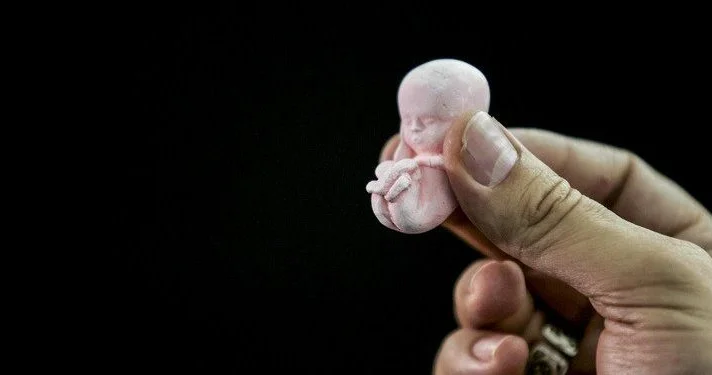 Qanunsuz abort edənlərə bu cəza veriləcək RƏSMİ