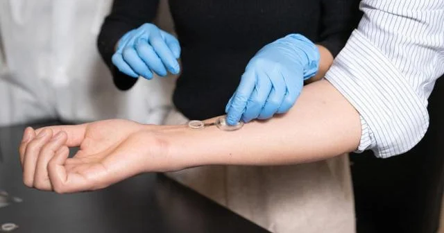 İnfeksiyaları günlər əvvəl aşkar edən ağıllı sarğı: iCares