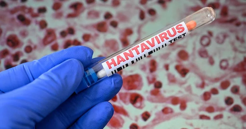 Heç bir sübut yoxdur ÜST hantavirusla bağlı məlumat yaydı