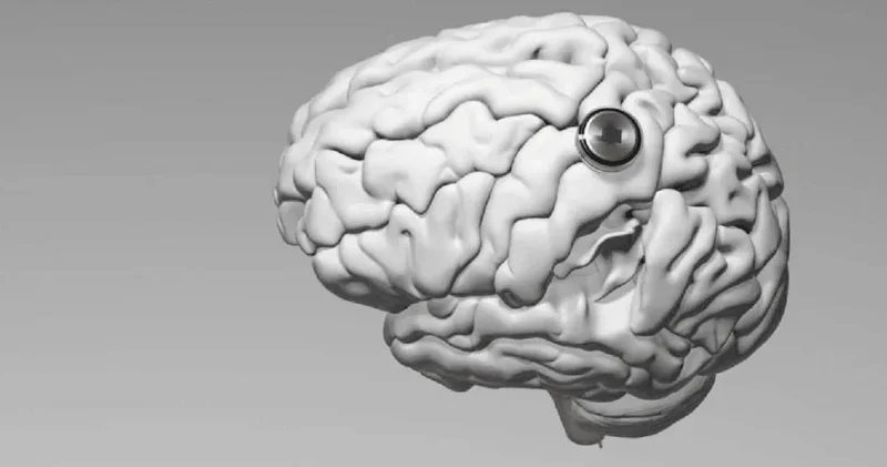 Çin insan beyninə implant yerləşdirdi: Artıq düşüncə ilə videooyun oynayır
