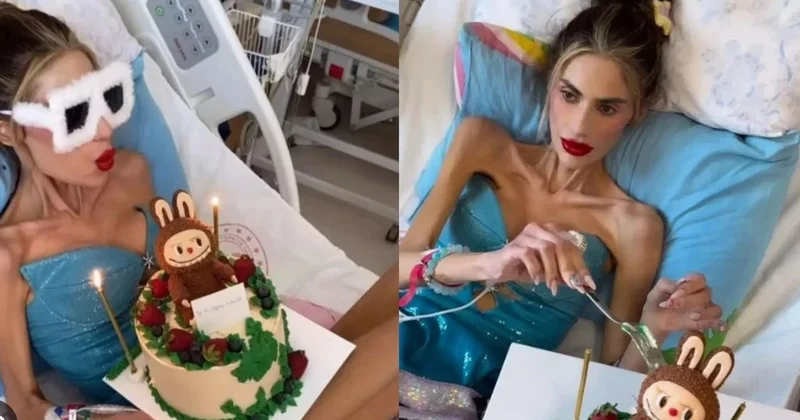 Anoreksiya xəstəsi olan fenomen daha 1 kilo arıqladı