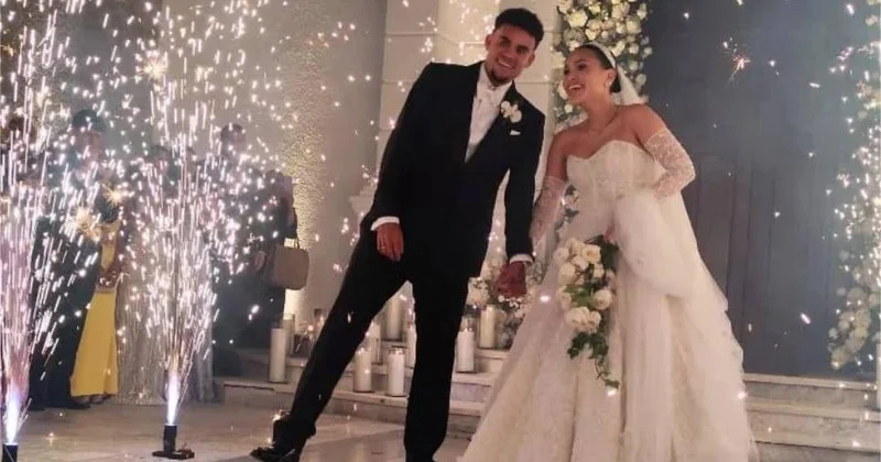 Luis Dias toydan əvvəl dişlərinə brilyant düzdürdü FOTO